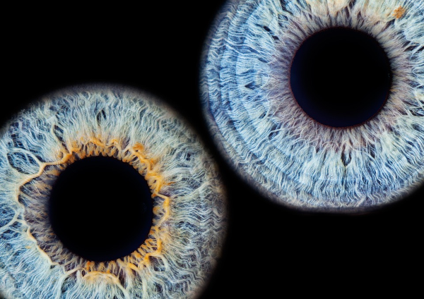 The Eyes Are The Window To The Soul: An Introduction To Iridology - Science Of The Soul